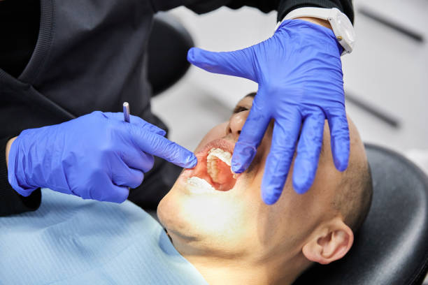 Best Emergency Dental Care for Broken or Chipped Teeth in Huntington Park, CA