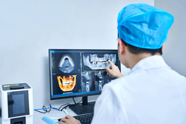 Best Emergency Root Canal Treatment in Huntington Park, CA